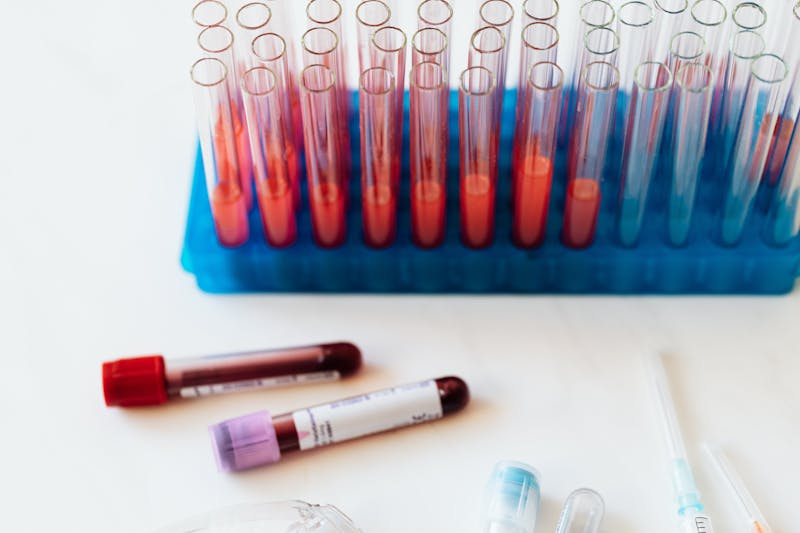 Blood sample vials in lab — STD panel testing