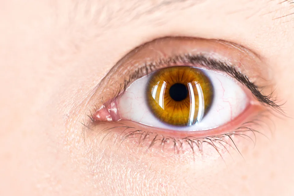 Close-up of a human eye