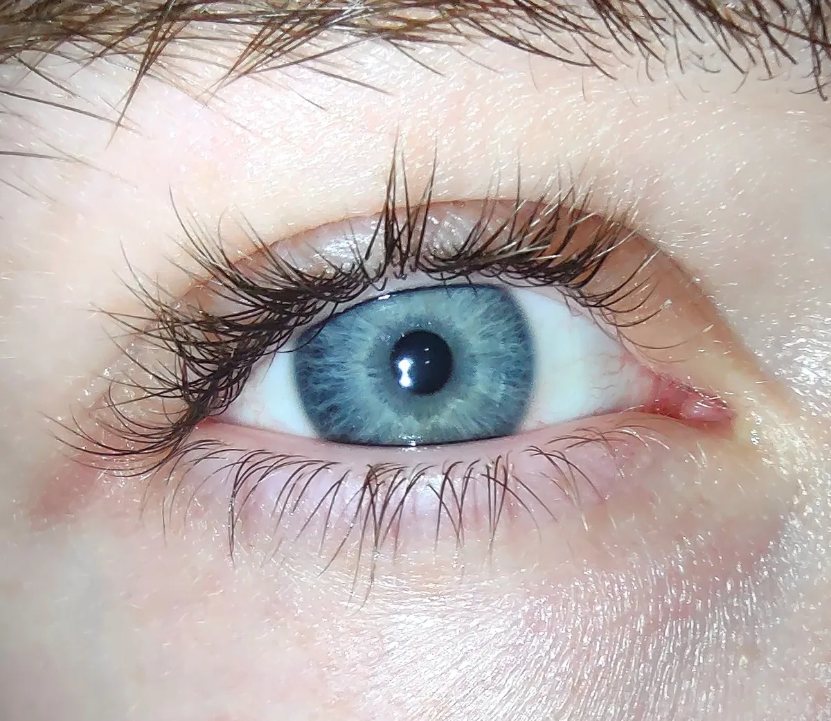 Close-up of a human eye and eyelid, where myokymia twitching occurs