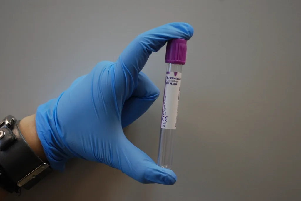 A gloved hand holding a laboratory sample tube, representing HPV screening and testing